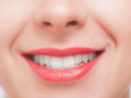 歯のホワイトニングは市販でも効果ある！自宅で白くする即効性の方法